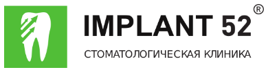 Логотип Имплант 52