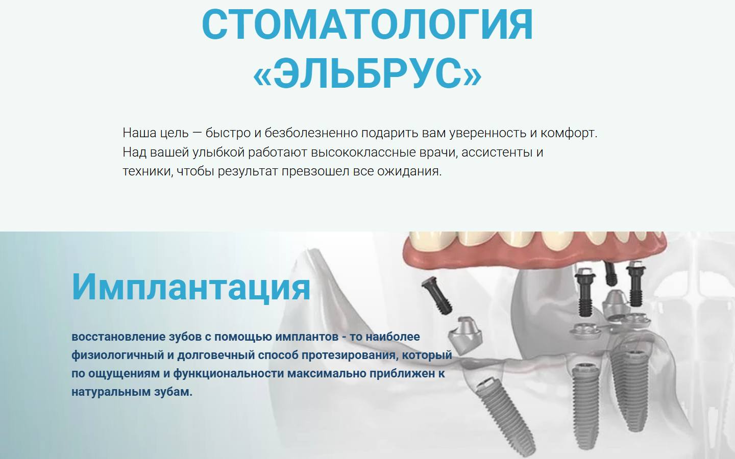 Главная страница сайта Эльбрус (elbrusdent.ru)