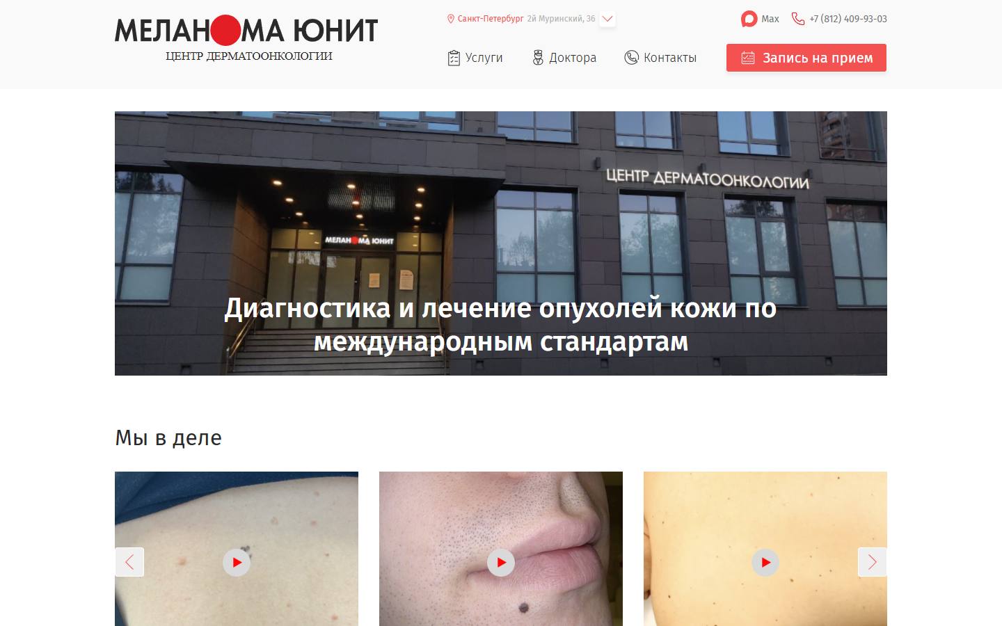 Главная страница сайта Меланома Юнит (melanomaunit.spb.ru)